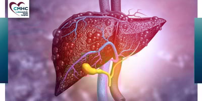 CMHC-Newsletter-May-010722-2