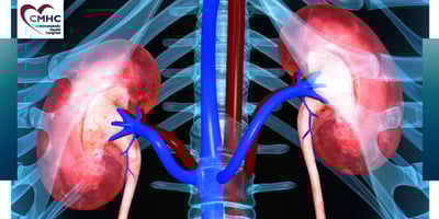 CMHC-Newsletter-May-010722-3